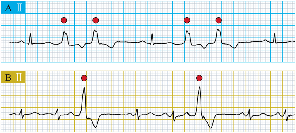 Curso Online Electrocardiografía Básica